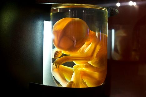 A preserved human foetus