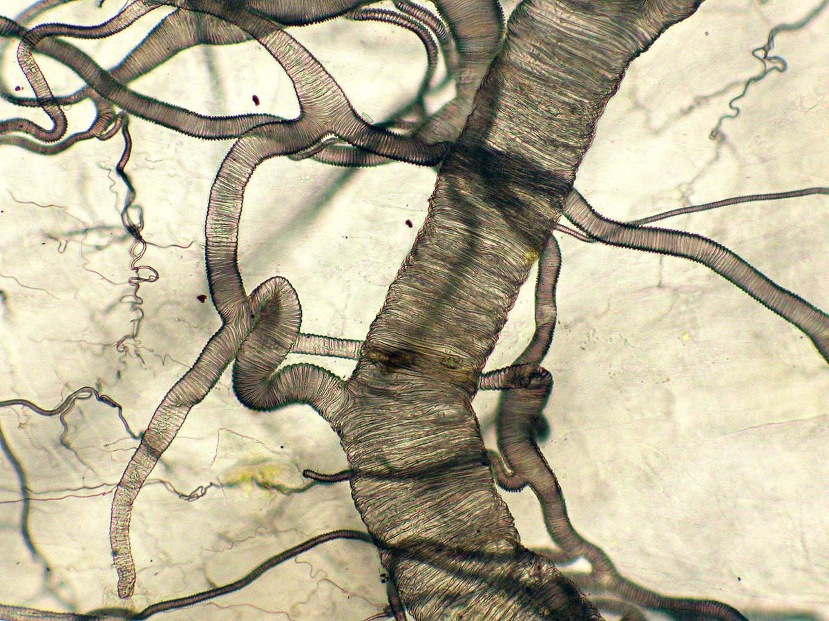 Respiratory tubes of <em>Apis mellifera</em>, a bee (Image of Distinction).