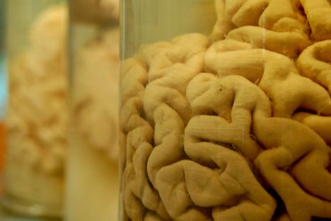 Brains preserved in jars.