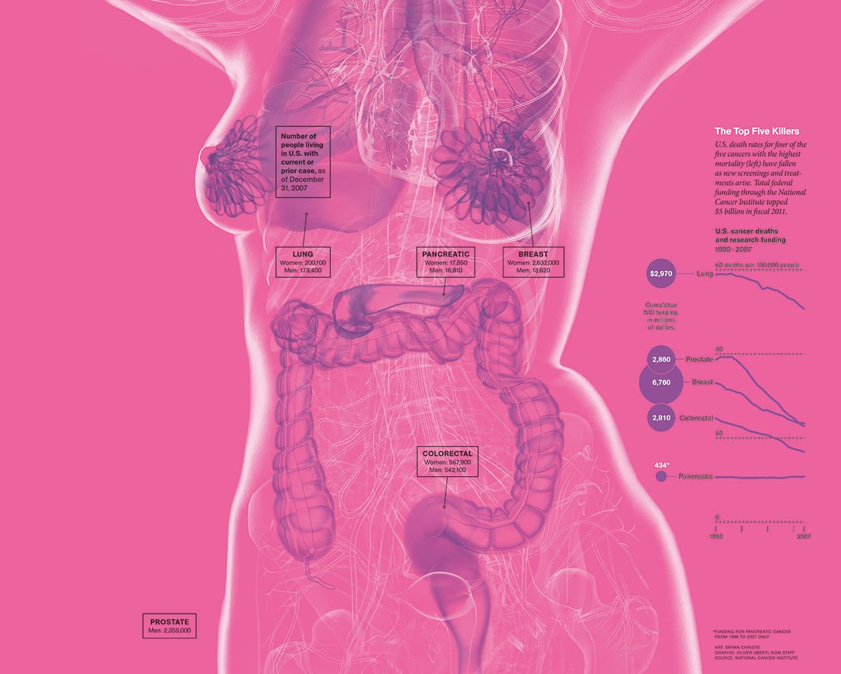 Cancer, October 2011.