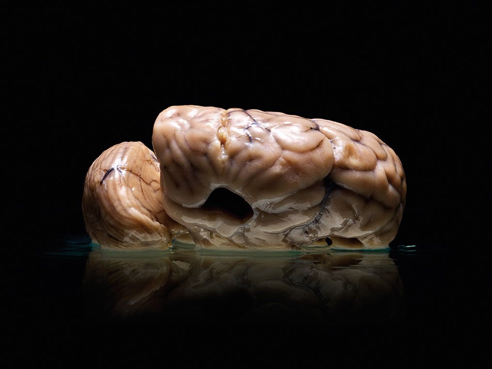 Visitors Can Touch Human Brains at This Indian Neuroscience