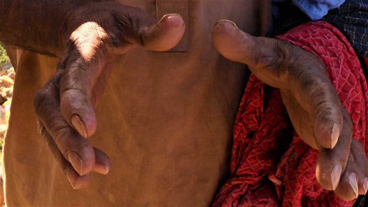 Harsh chemicals are used to clean the soiled clothes. When Muhammad Naqeel created a bank account, a machine was unable to register the fingerprints on his weathered hands.