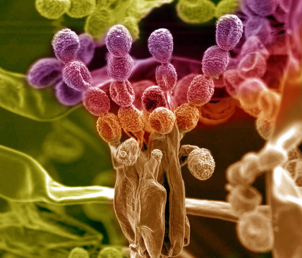 A species of <em>Penicillium</em> soil fungus that sometimes lives on plant roots. 