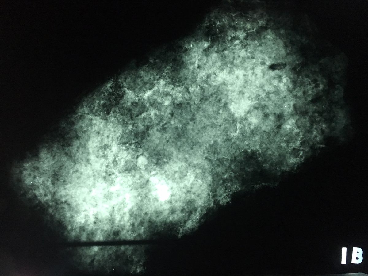 The X-ray image of the fatberg looks a bit like a milky, far-off galaxy.
