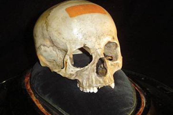 Said to be Mozart's Skull