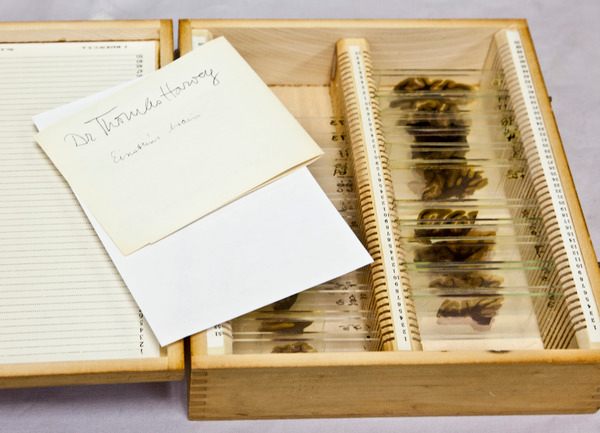 Thomas Harvey, the pathologist who performed Einstein’s autopsy, took his without permission. (Einstein wished to be cremated.) 