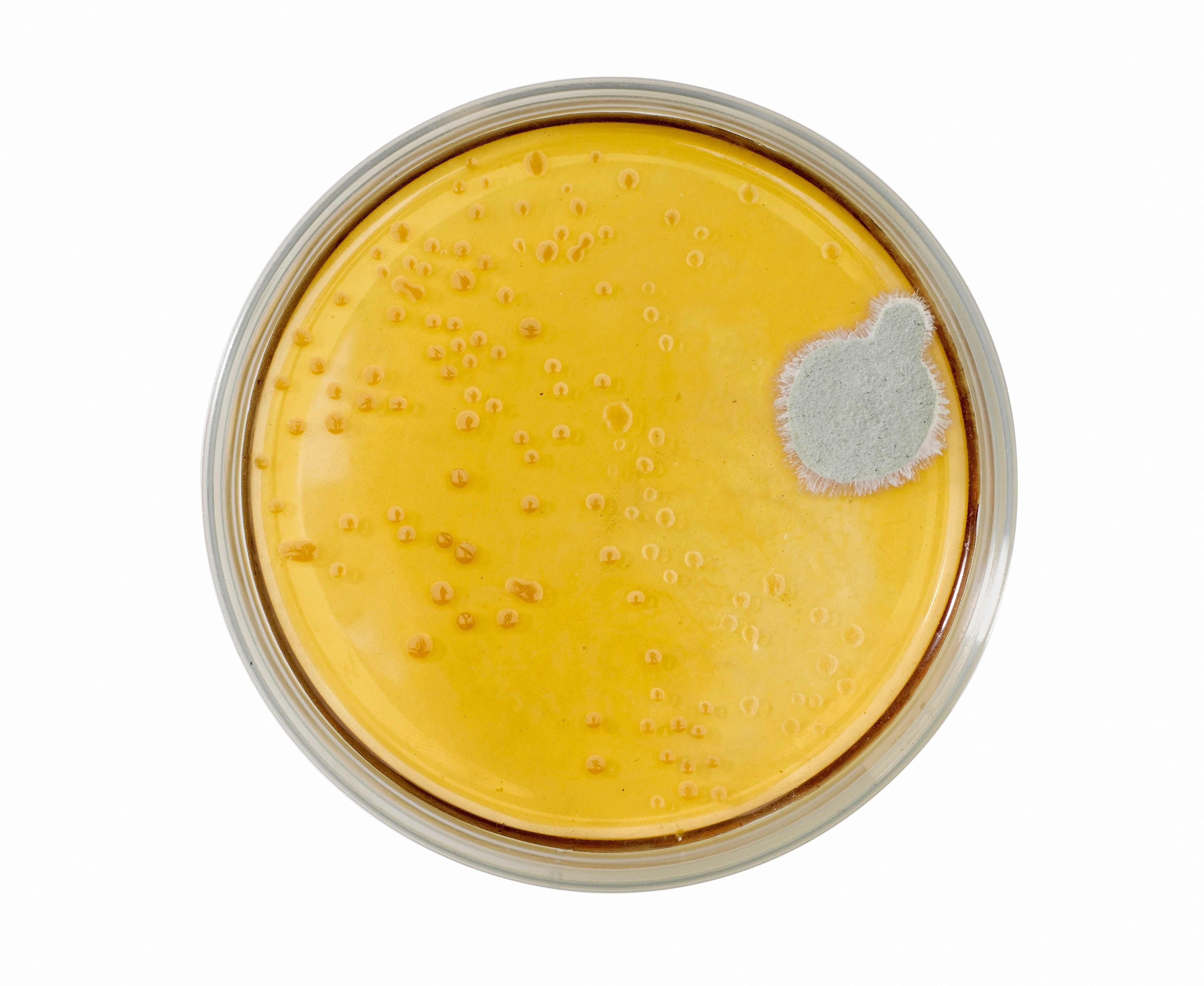 <em>Penicillium</em> mold growing on a culture in 1963.