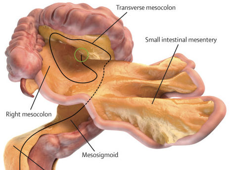 Scientists created this mockup of the mesentery and related body parts.