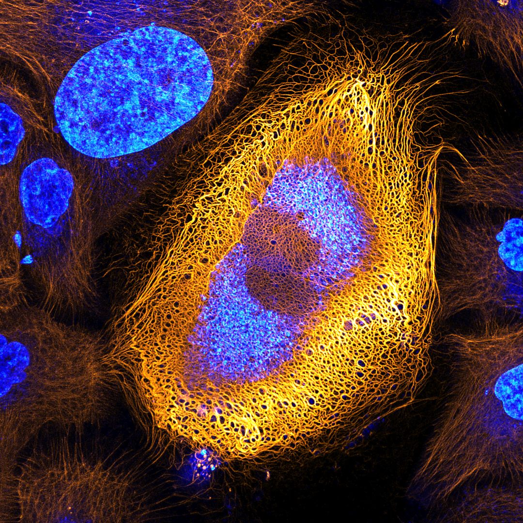 Immortalized human skin cells (HaCaT keratinocytes) expressing fluorescently tagged keratin (1st Place).