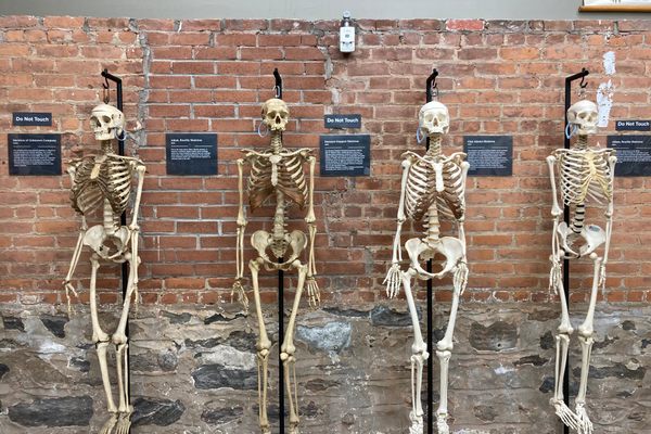 The collection includes eight intact human skeletons. 