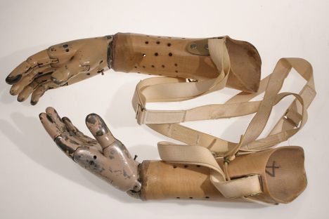 Prosthetic hands