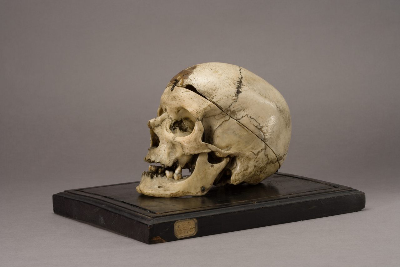 Cesare Lombroso, a prominent 19th-century Italian scientist, based his life's work on the skull of a man he called "brigand Villella"—but little was known about Giuseppe Villella until recently.