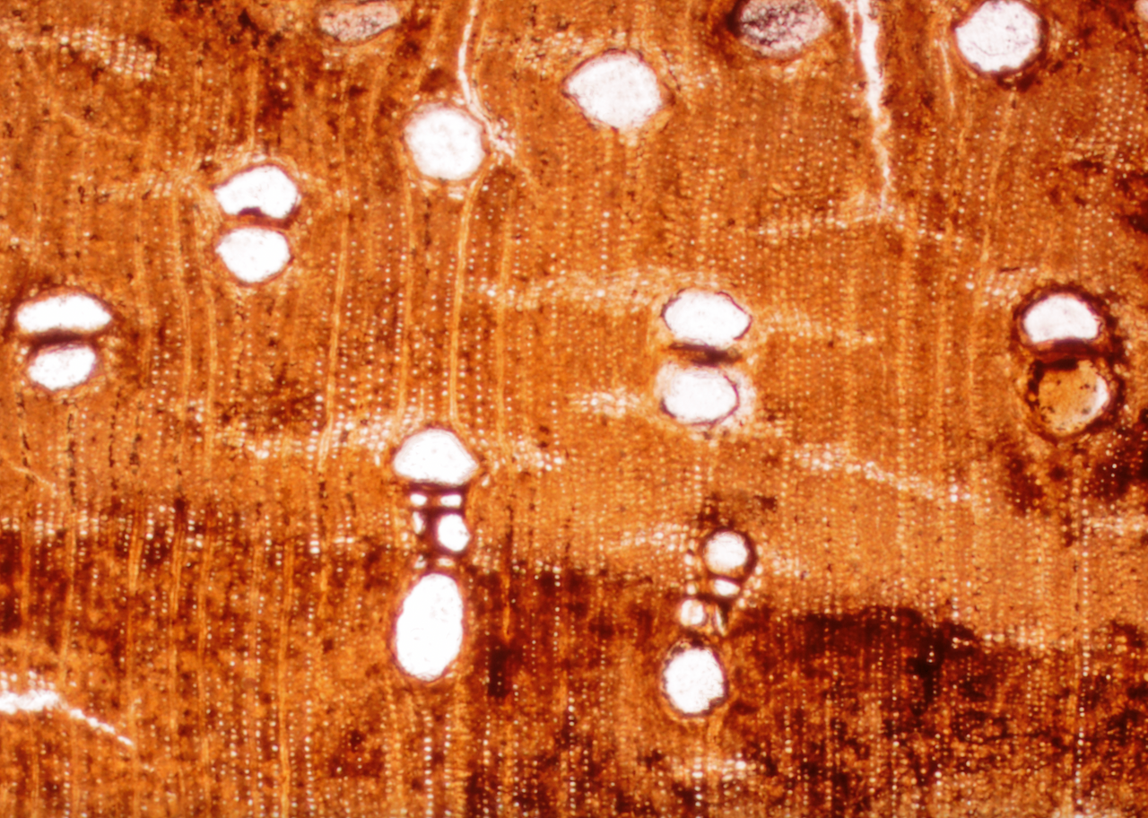A thin section of petrified wood identified as <em>Cynometra</em>, a genus of tree also found throughout the tropics today.