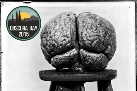 See These Stunning Photos Of Brain Surgery's Earliest Patients