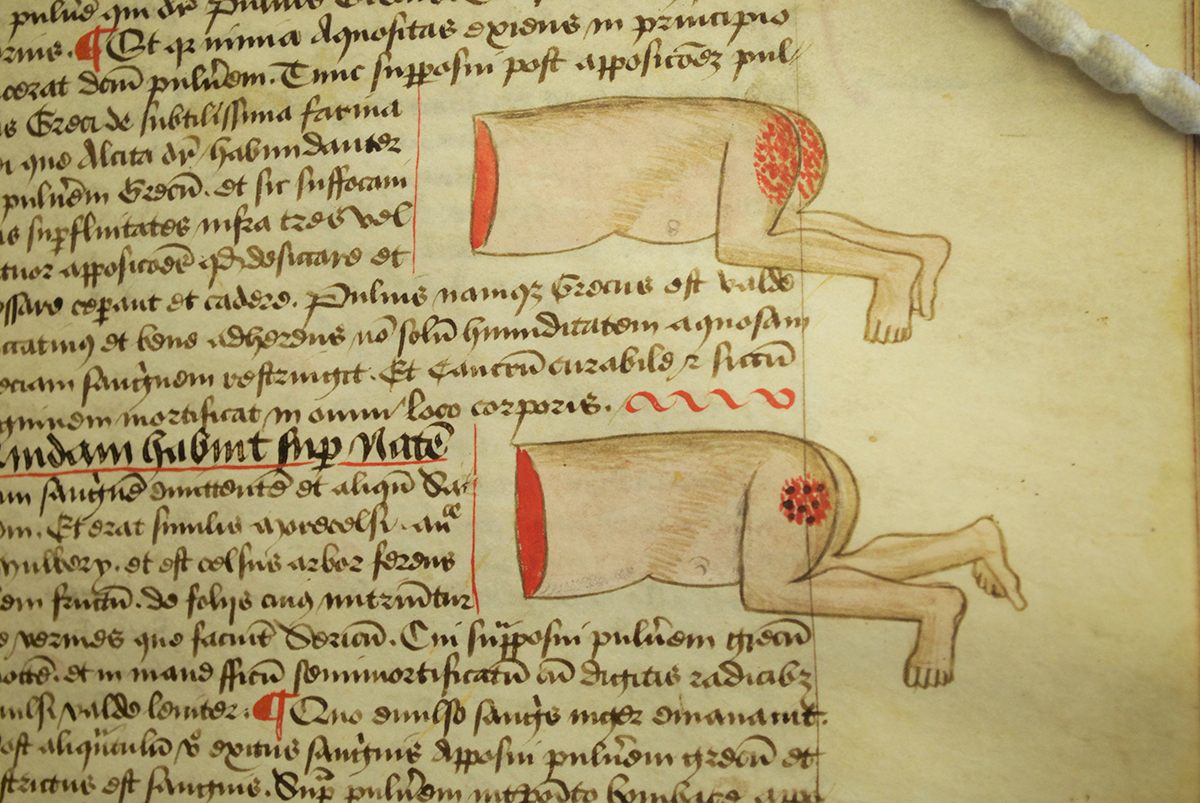 The Strange and Grotesque Doodles in the Margins of Medieval Books - Atlas  Obscura