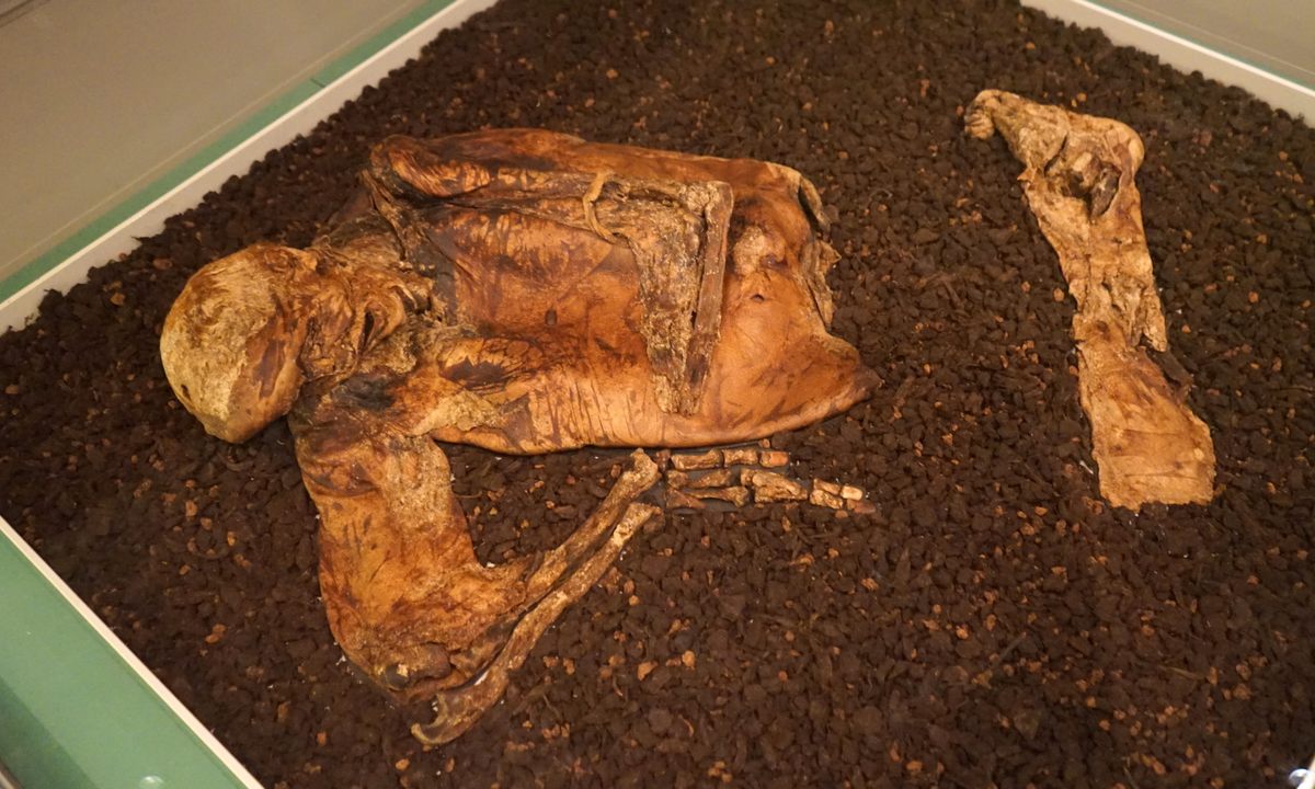 The Lindow Man's body was so well preserved in the peat bog that scientists could confirm his last meal consisted of mistletoe pollen and burnt flatbread.