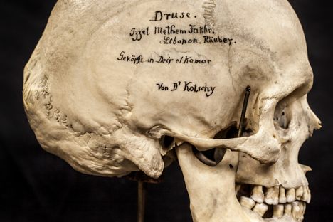 Objects of Intrigue: Every Skull Has a Story