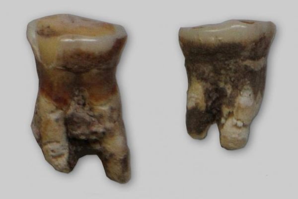 Dental plaque in these teeth provide evidence that Mediterranean ancestors ate fish and plants. 