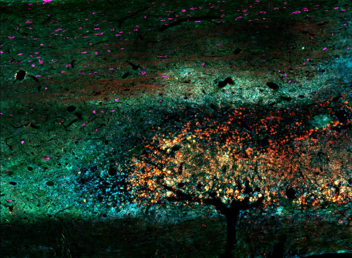 <em>Fall Landscape</em>, Honorable Mention 2015. A rodent spinal cord injected with modified lipid nanoparticles.