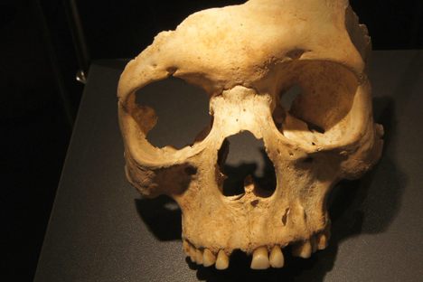 The Herxheim Death Ritual Skeletons