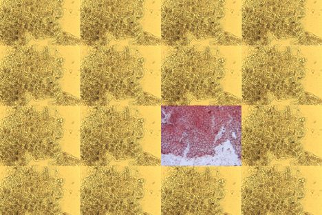 Carrot and apple skin under the microscope, from Forensic Plant Science.