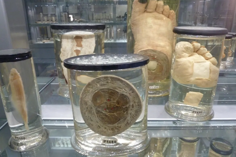 The Hunterian Museum in London.