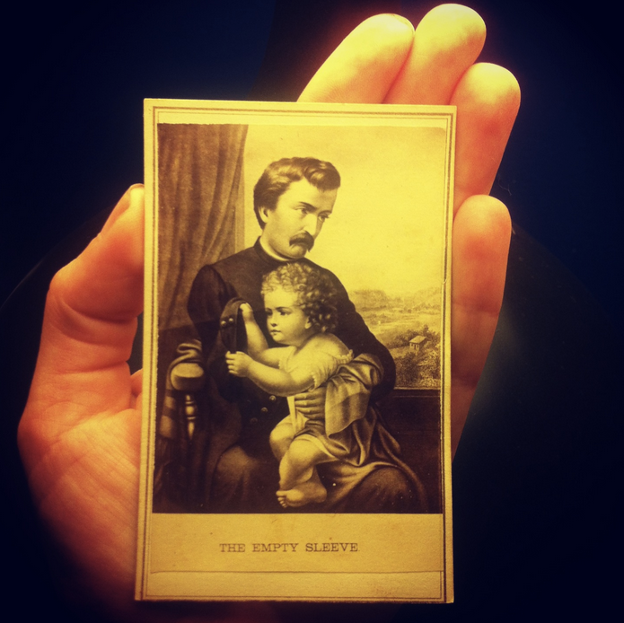 Civil War-era photograph of a child discovering an amputated limb