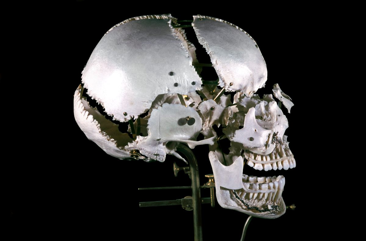 A 19th-century skull disarticulated and presented using the Beauchêne Method.
