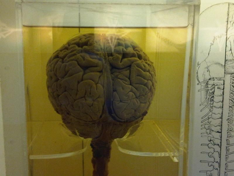 The Inept Story Behind 100 Missing Brains at the University of Texas -  Atlas Obscura