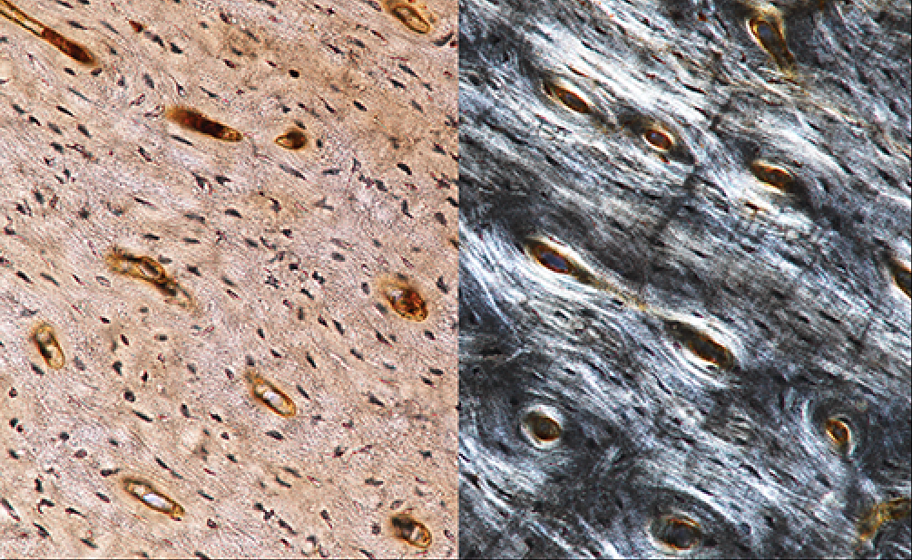 Microscopic analysis of fossils can say a lot about the lives of dinosaurs.