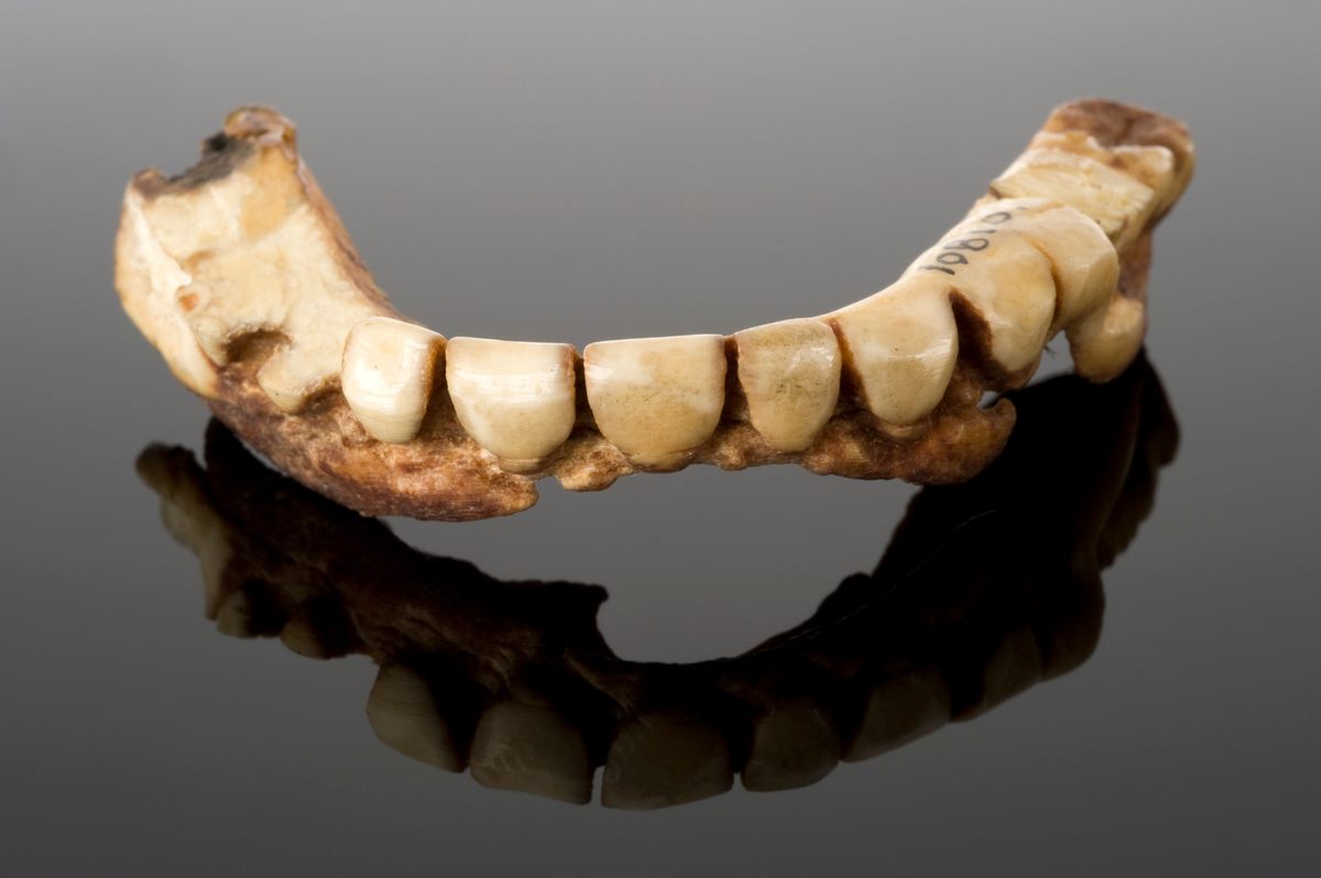 Dentures, like this ivory one likely made in France in the 1800s, tended to deteriorate and smell foul.