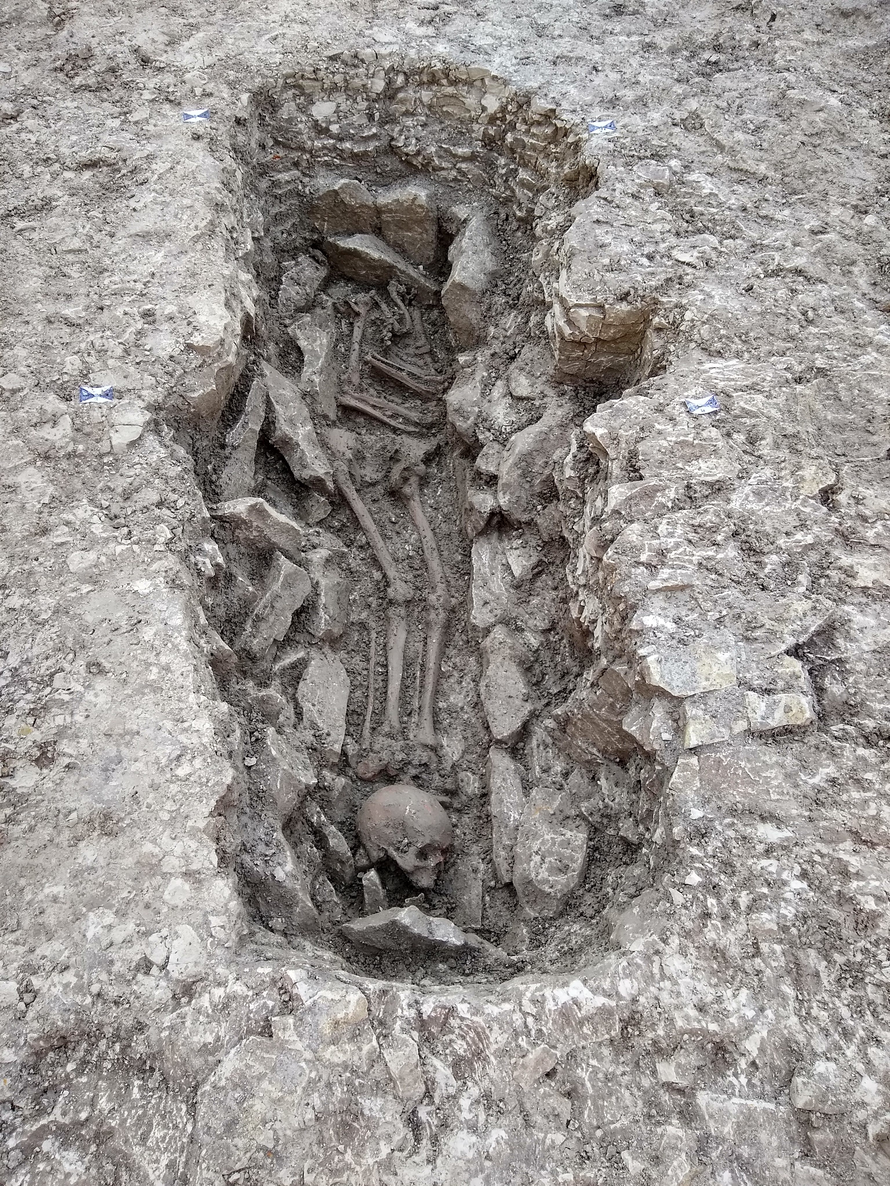 A skeleton with its skull placed at its feet.