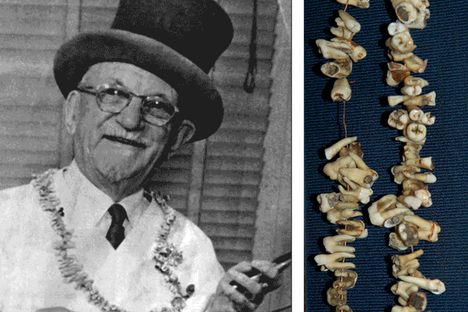 Curious Fact of the Week: When Dental Work Came With Song, Dance, and Cocaine