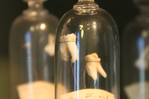 Teeth in tiny bell jars 