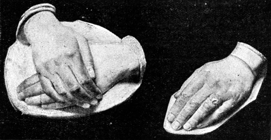 Casts of the hands of Princess Beatrice and Princess Louise, as part of a feature about hands in an 1893 edition of <em>The Strand Magazine</em>.