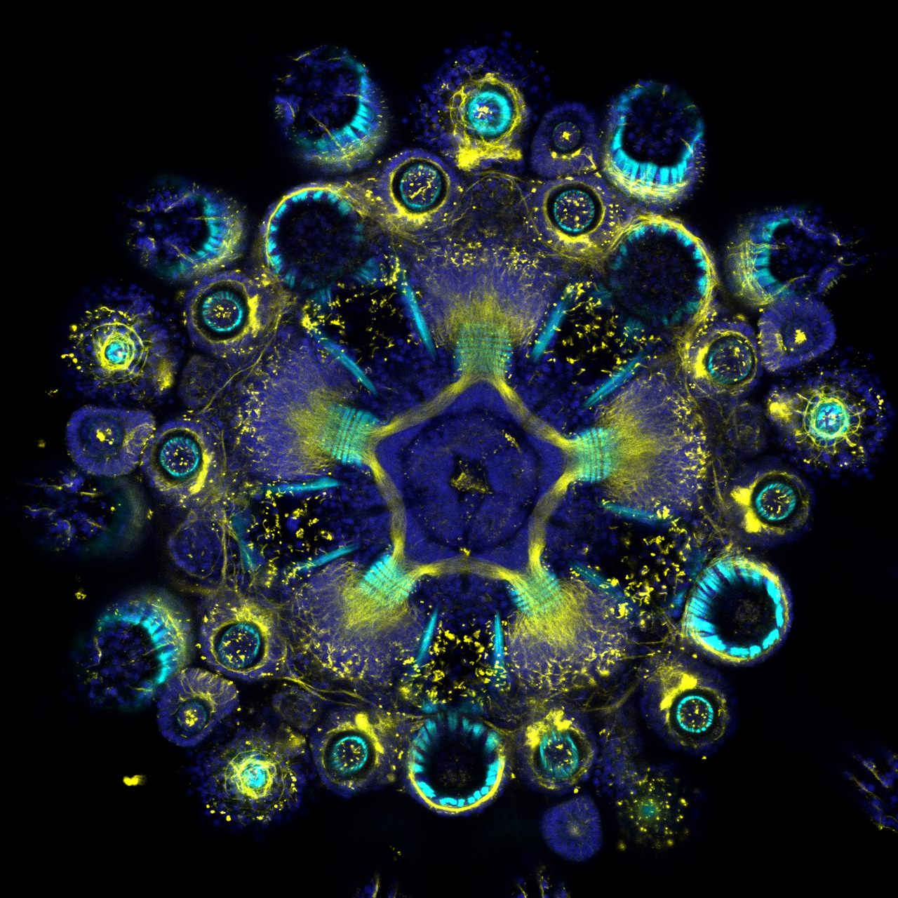 A cross-section of a juvenile sea urchin reveals its neural network in yellow and muscle fibers in bright blue.