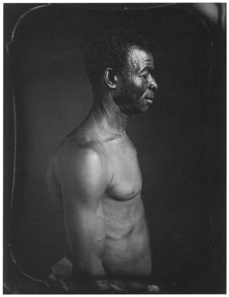 Agassiz commissioned this daguerreotype of an enslaved man named Jack, who was born on the Coast of Guinea and lived on a plantation in Columbia, South Carolina.