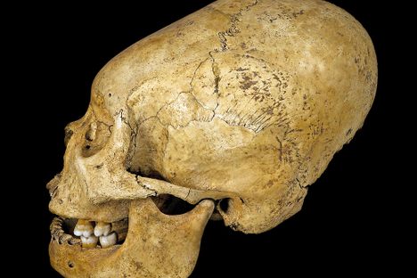 Head Space: Behind 10,000 Years of Artificial Cranial Modification