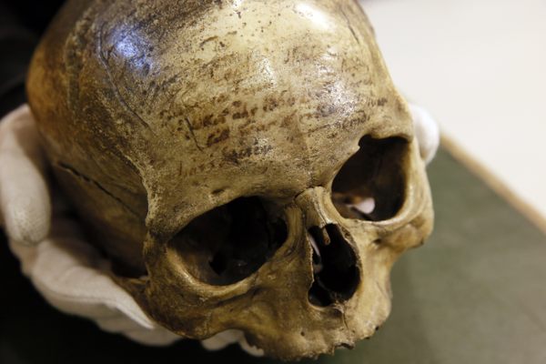 According to the Musée de l'Homme in Paris and many historians and forensic experts, this is the skull of French philosopher René Descartes. Swedish researchers disagree. 