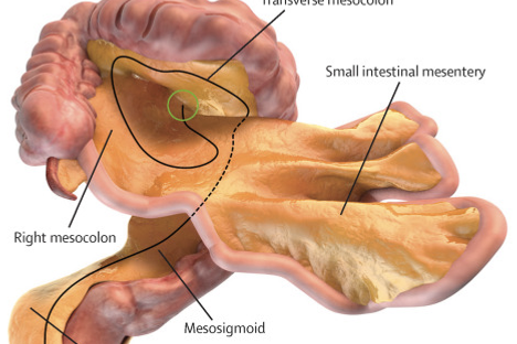 Scientists created this mockup of the mesentery and related body parts. 