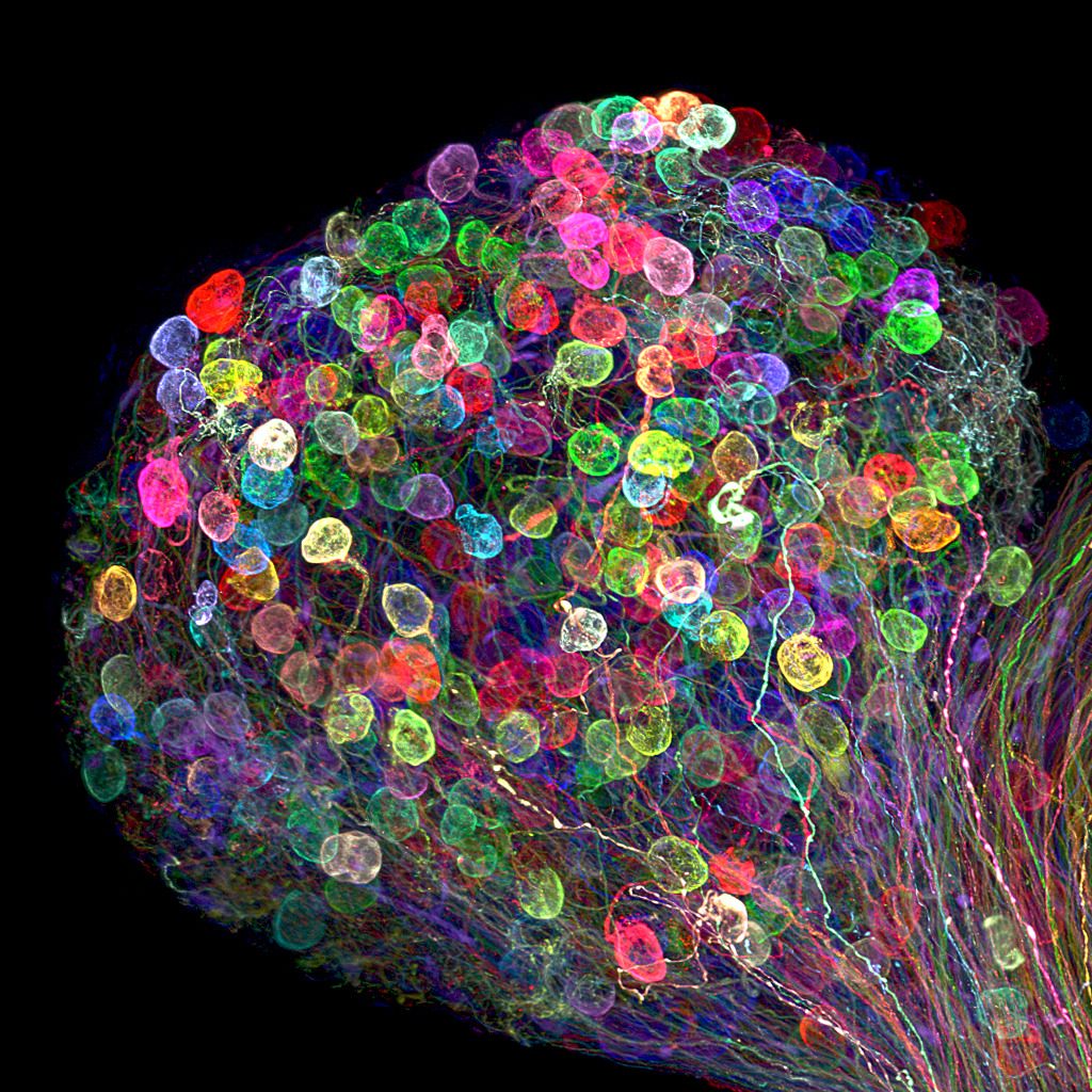 Individually labeled axons in an embryonic chick ciliary ganglion, (7th Place).