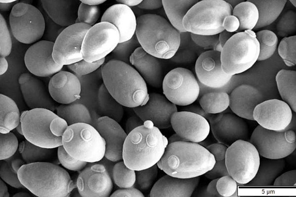 Saccharomyces cervisiae.