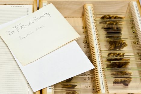 Objects of Intrigue: Einstein's Brain