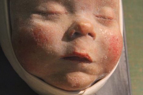 Wax Moulage 2