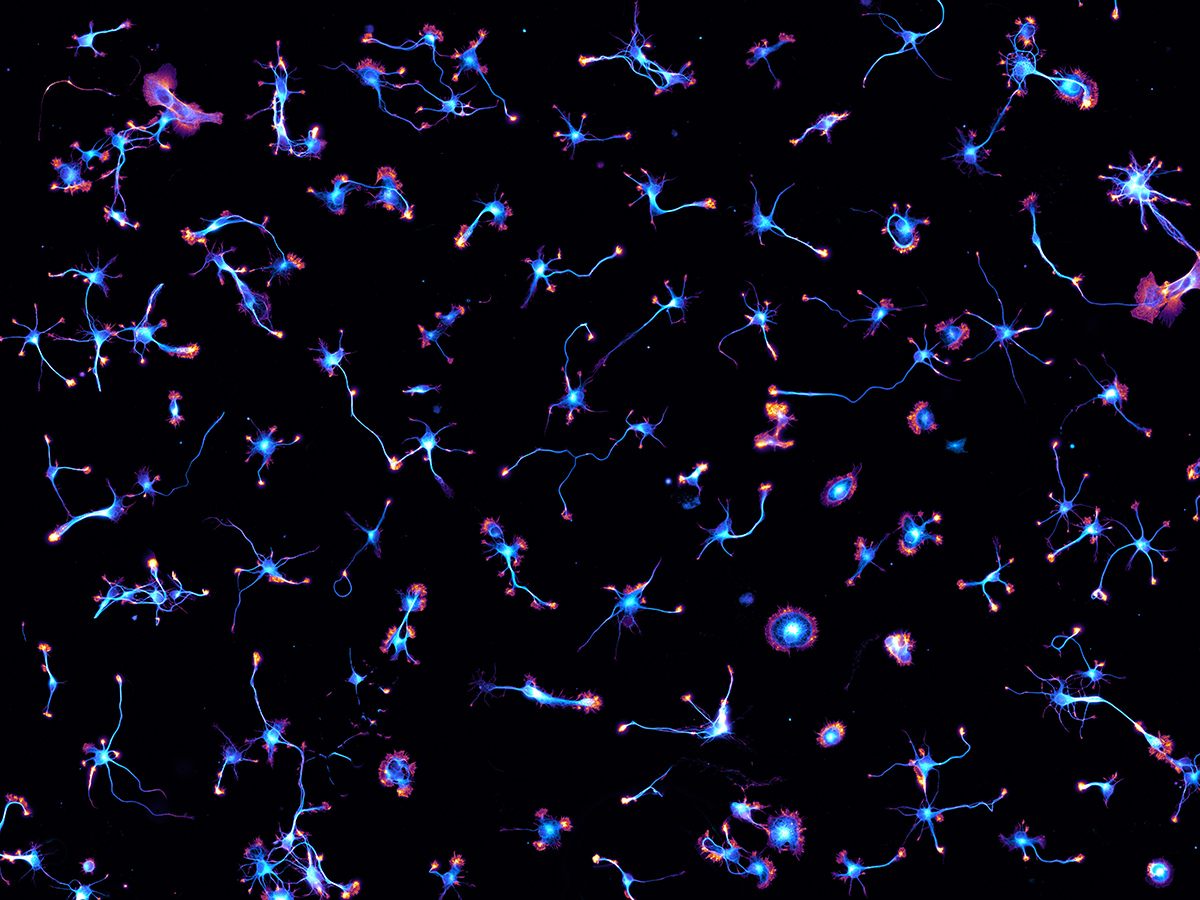 <em>Starry Night</em>, Staff Pick 2017. This image shows hippocampal neurons after two days in culture. 