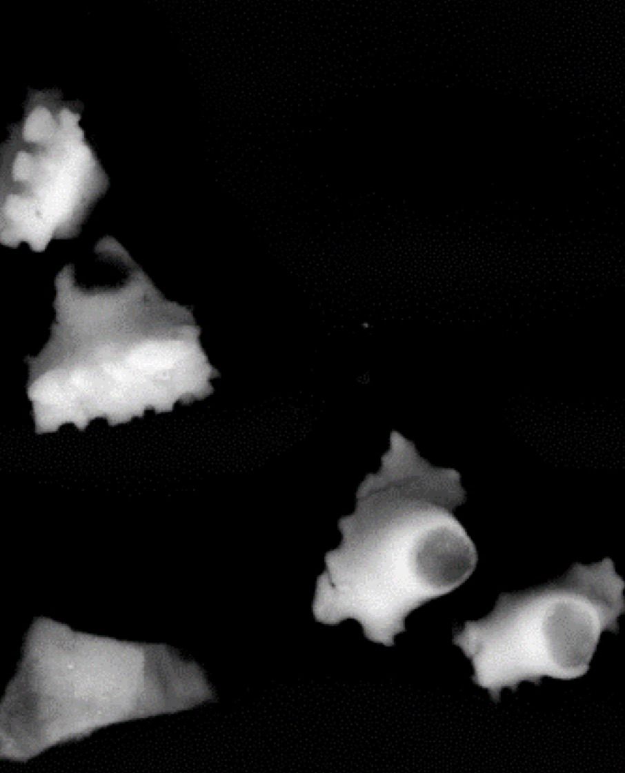 Seen under a microscope, banana-leaf phytoliths "look like little, tiny volcanoes," Tromp says.