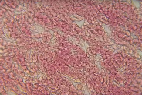 See What Your Blood Looks Like Under a Microscope