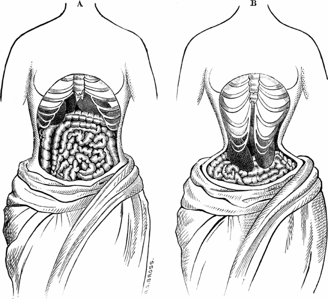 The Horrifying Legacy of the Victorian Tapeworm Diet Gastro Obscura