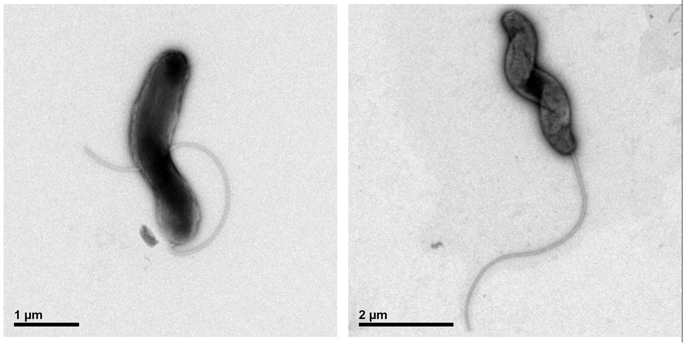The <em>Marinomonas promoryiensis</em> bacterium.