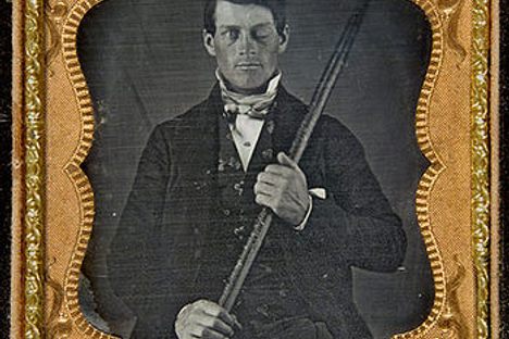 Morbid Monday: Phineas Gage - Miraculous Survivor, Sideshow Wonder, Jerk